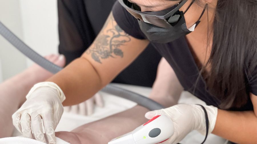 woman performing laser hair removal