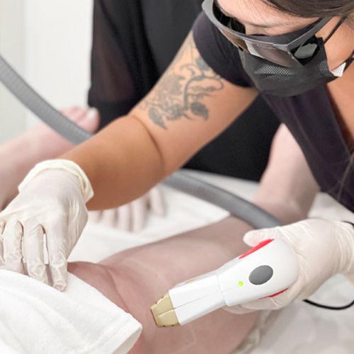 Woman holding laser hair removal handle against another woman's leg