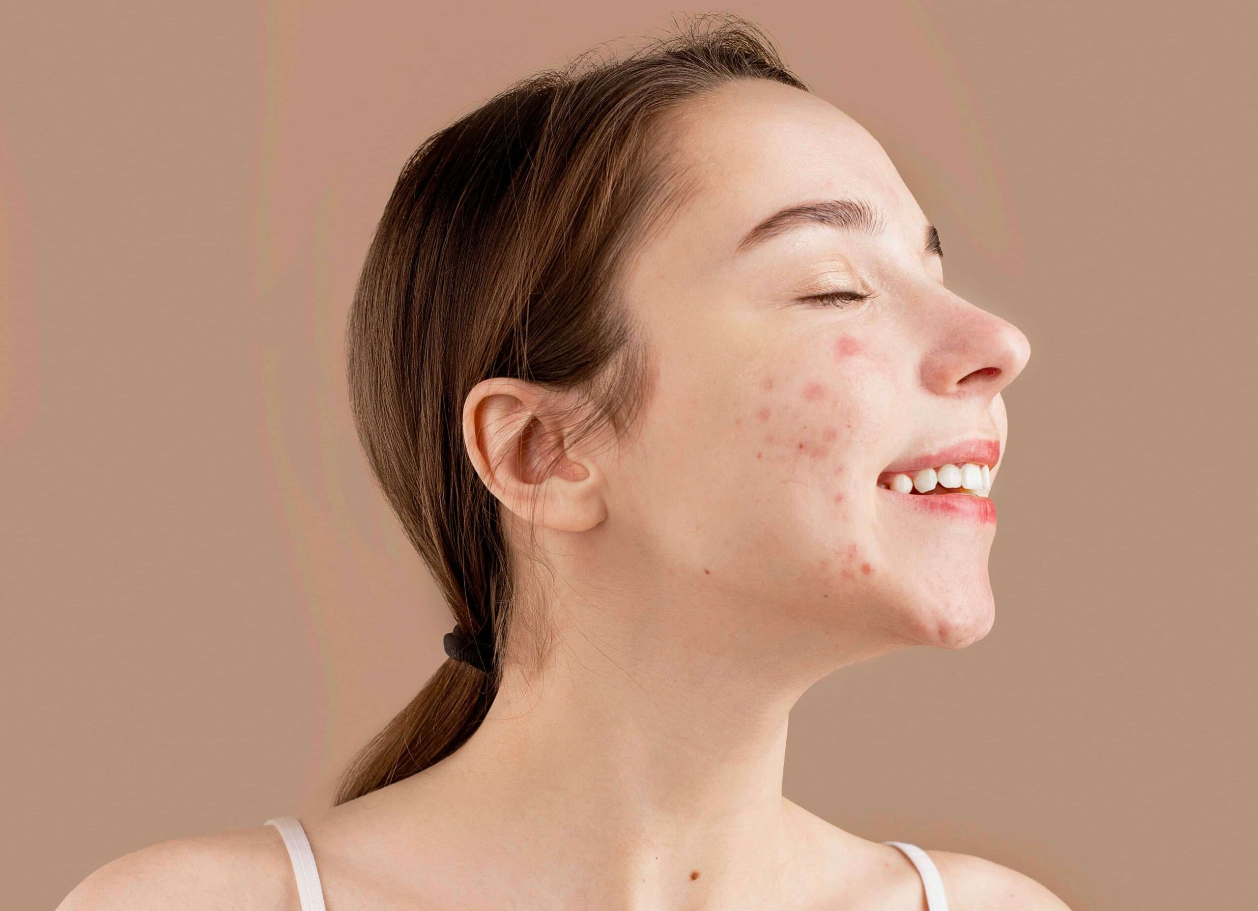 Smiling client after a customized acne care session by a student from Esthetician Schools in Winnipeg