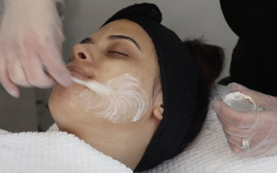 Is a Chemical Peel Course in Winnipeg Worth It? Here’s Why We Include It