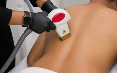 Start Your Esthetics Career With A Laser Technician Course In Winnipeg