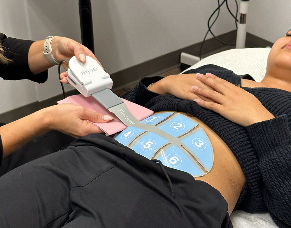 A hands-on training moment from a laser technician course Winnipeg set in a clean, clinical treatment room, where a practitioner adjusts blue body contouring pads on a client’s abdomen. The client lies relaxed on a treatment bed with hands resting on their chest, wearing a headband and comfortable clothing. The practitioner sits beside the bed, focused on proper placement and technique. In the background, a magnifying lamp, organized skincare products on a tray, and minimal medical equipment reinforce a professional learning environment centered on advanced aesthetic treatments.